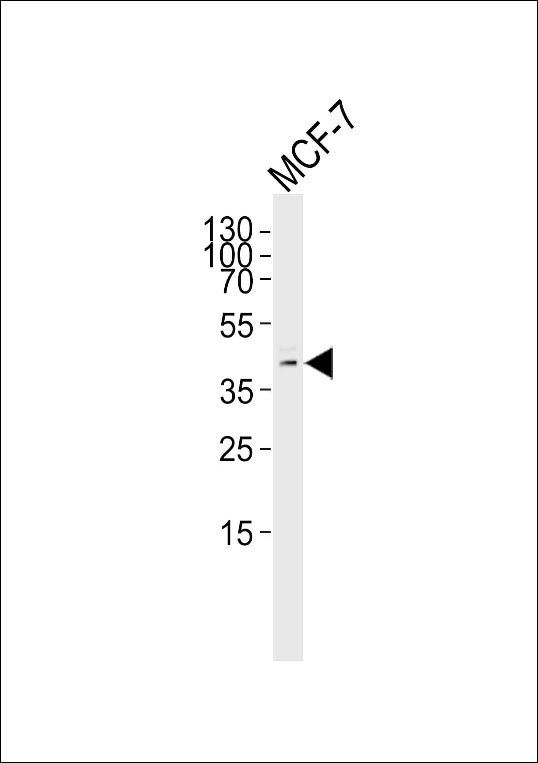 USP2 Antibody (aa508-538)