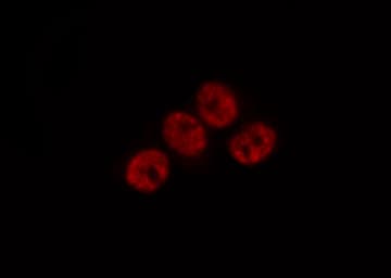 Polyclonal Rabbit anti-Human AP-1 / JUND Antibody (IHC, IF, WB)