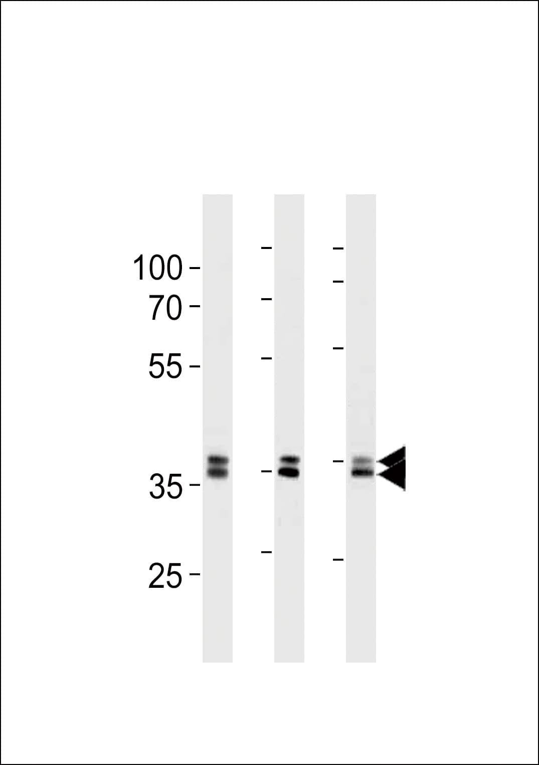 UCHL5 / UCH37 Antibody (clone 854CT5.5.6)