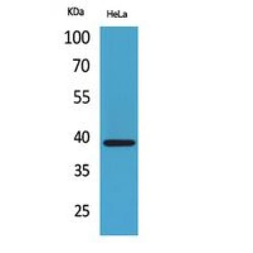 Polyclonal Rabbit anti-Human CXCR6 Antibody (1-50 aa, N-terminal, IHC, WB)