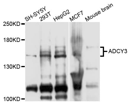 ADCY3 / Adenylate Cyclase 3 Antibody (Cy3)