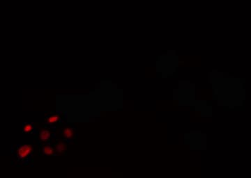 FOXK1 / MNF Antibody