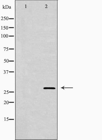 Polyclonal Rabbit anti-Human CD151 Antibody (IHC, IF, WB)