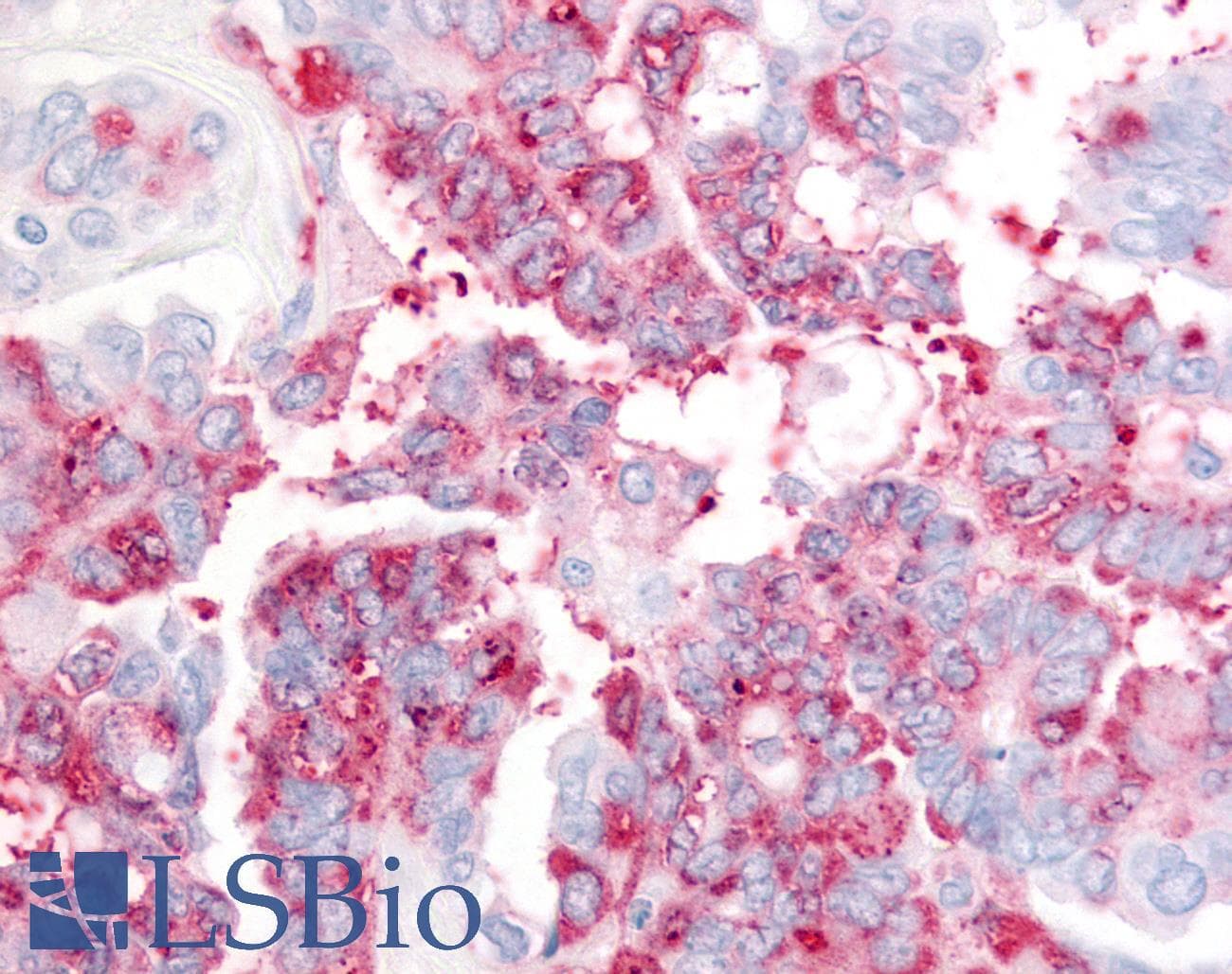 PathPlus™ USP20 / VDU2 Antibody (Internal)