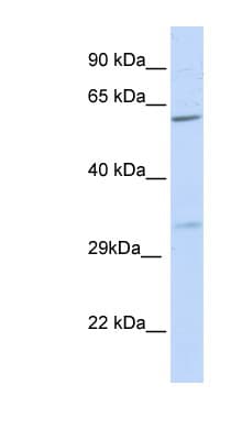 Polyclonal Rabbit anti-Human PRPS2 Antibody (N-Terminus, WB)