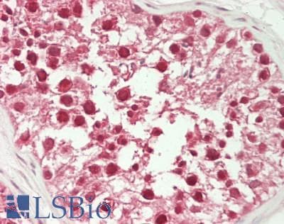 IHC-plus™ BABAM1 / HSPC142 Antibody (aa175-225)