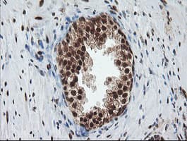 COPS5 / JAB1 Antibody (clone OTI2B12)