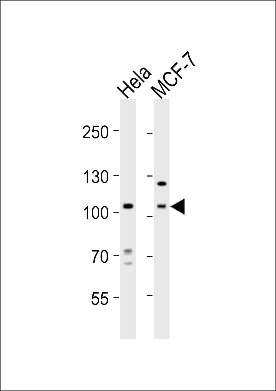 EPHA4 / EPH Receptor A4 Antibody (aa417-451)