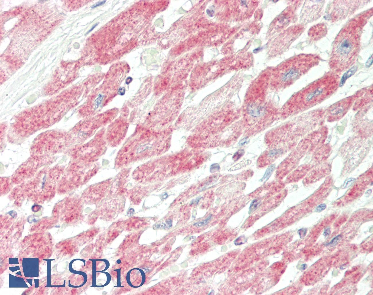 PDE4B Antibody (aa467-516)