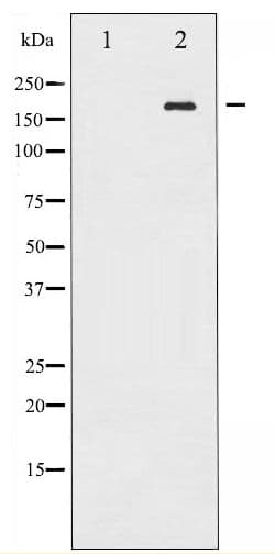 Polyclonal Rabbit anti-Human EGFR Antibody (phospho-Tyr869, WB)