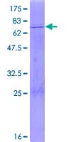 Human PDHA2 / PDH E1 Beta Protein (Recombinant GST)