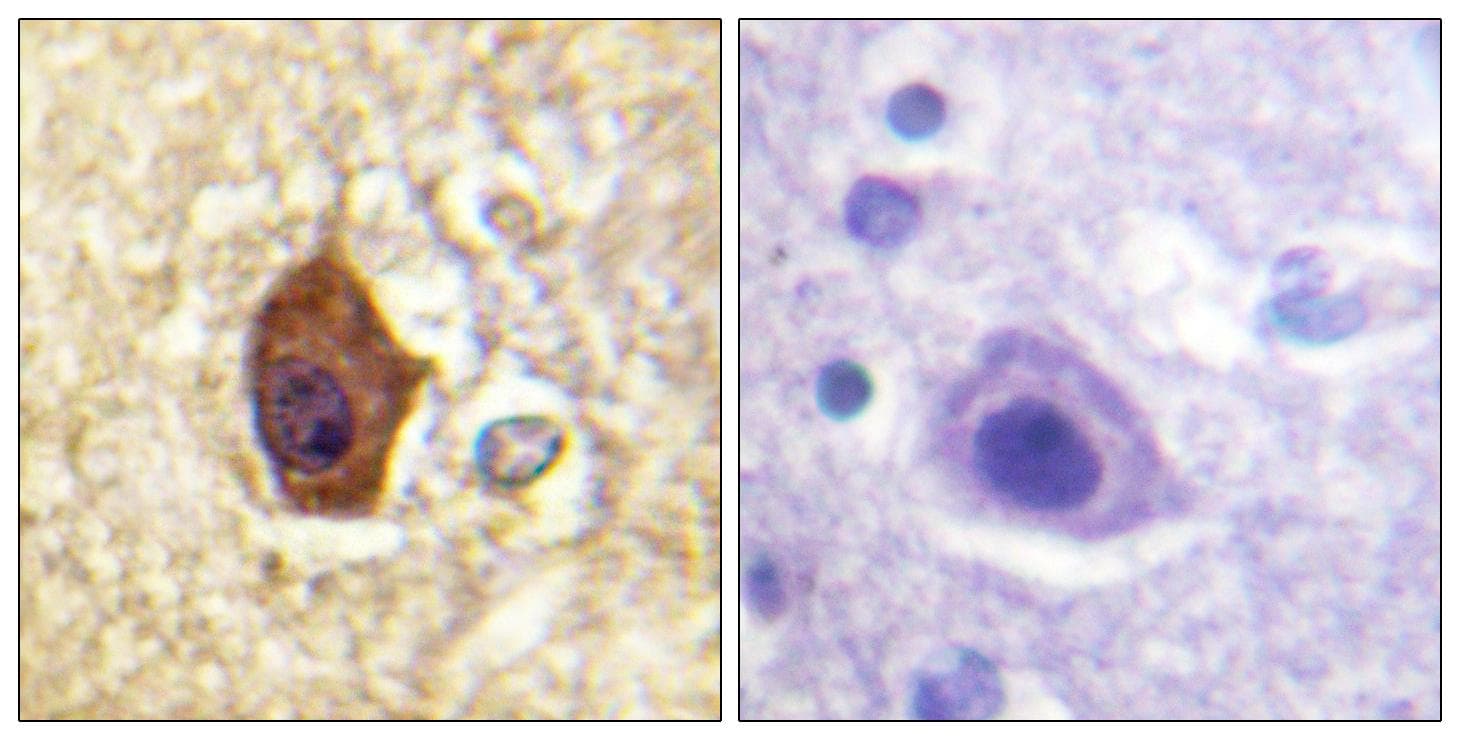 SYN1 / Synapsin 1 Antibody