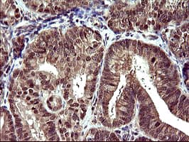 UPRT Antibody (clone OTI3A3, Carrier-free)