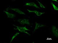 DHX29 Antibody (clone 2269C1)