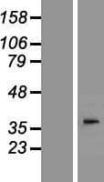 Human AWAT2 / DGAT2L4 Protein (Over-Expression Lysate Myc-DDK (Flag))