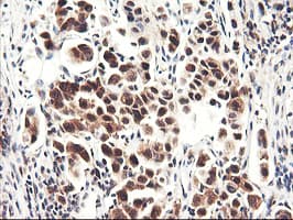 NLN / Neurolysin Antibody (clone OTI3A12)