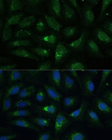 Polyclonal Rabbit anti-Human ACLP / AEBP1 Antibody (IF)