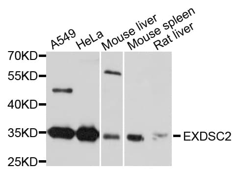 EXOSC2 / RRP4 Antibody