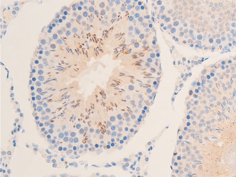 Polyclonal Rabbit anti-Human NFKBIE / IKB Epsilon Antibody (phospho-Ser22, IHC, IF, WB)