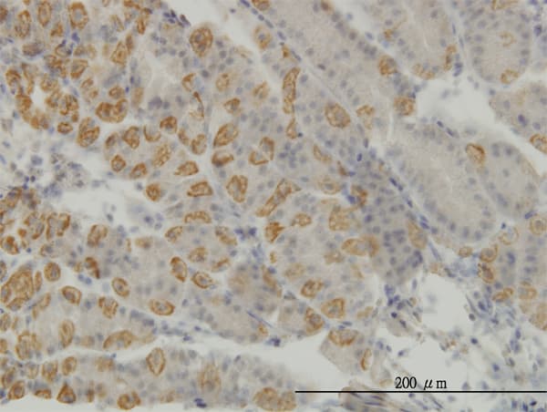 AATK / AATYK Antibody (clone 5H5)