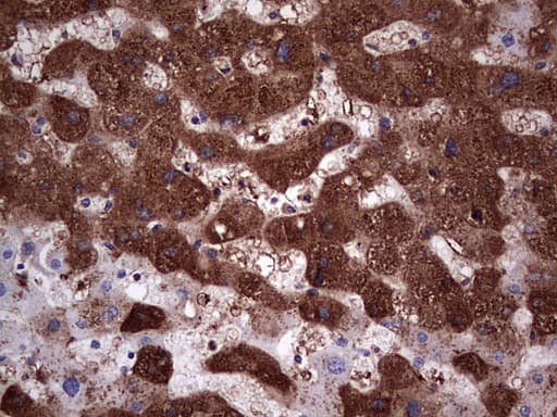 Monoclonal Mouse anti-Human PKM2 Antibody (clone 11B11, IHC, WB)