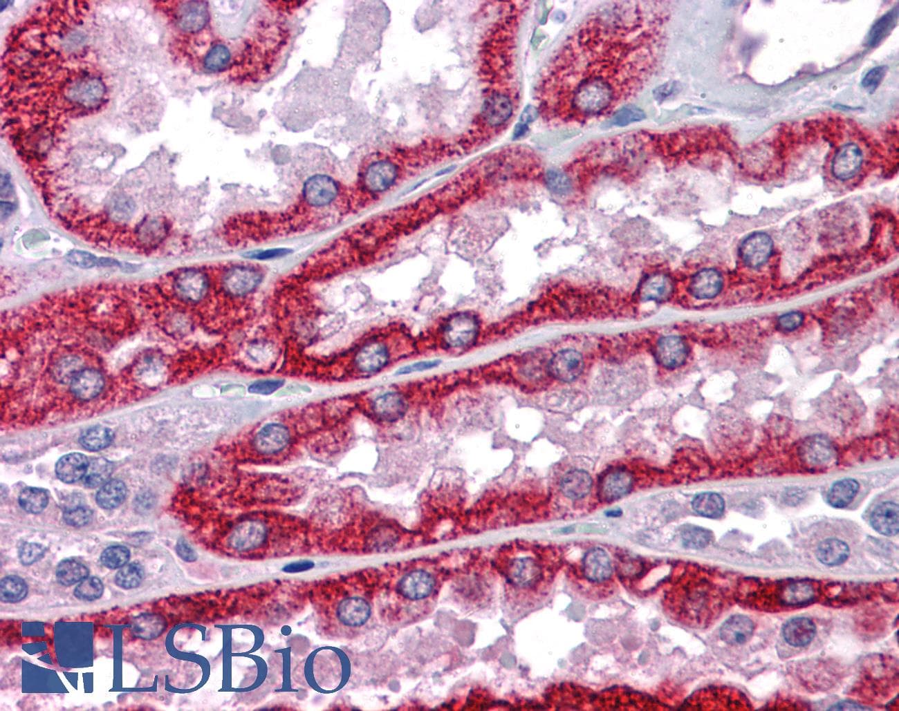 IHC-plus™ RIPK1 / RIP Antibody