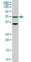 Monoclonal Mouse anti-Human STK40 Antibody (clone 4G3, IHC, WB)