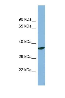 Polyclonal Rabbit anti-Human PDXP / Pyridoxal Phosphatase Antibody (aa58-107, WB)