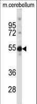IHC-plus™ TSPYL5 Antibody (aa344-372)