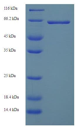 Human PKLR Protein (Recombinant His)