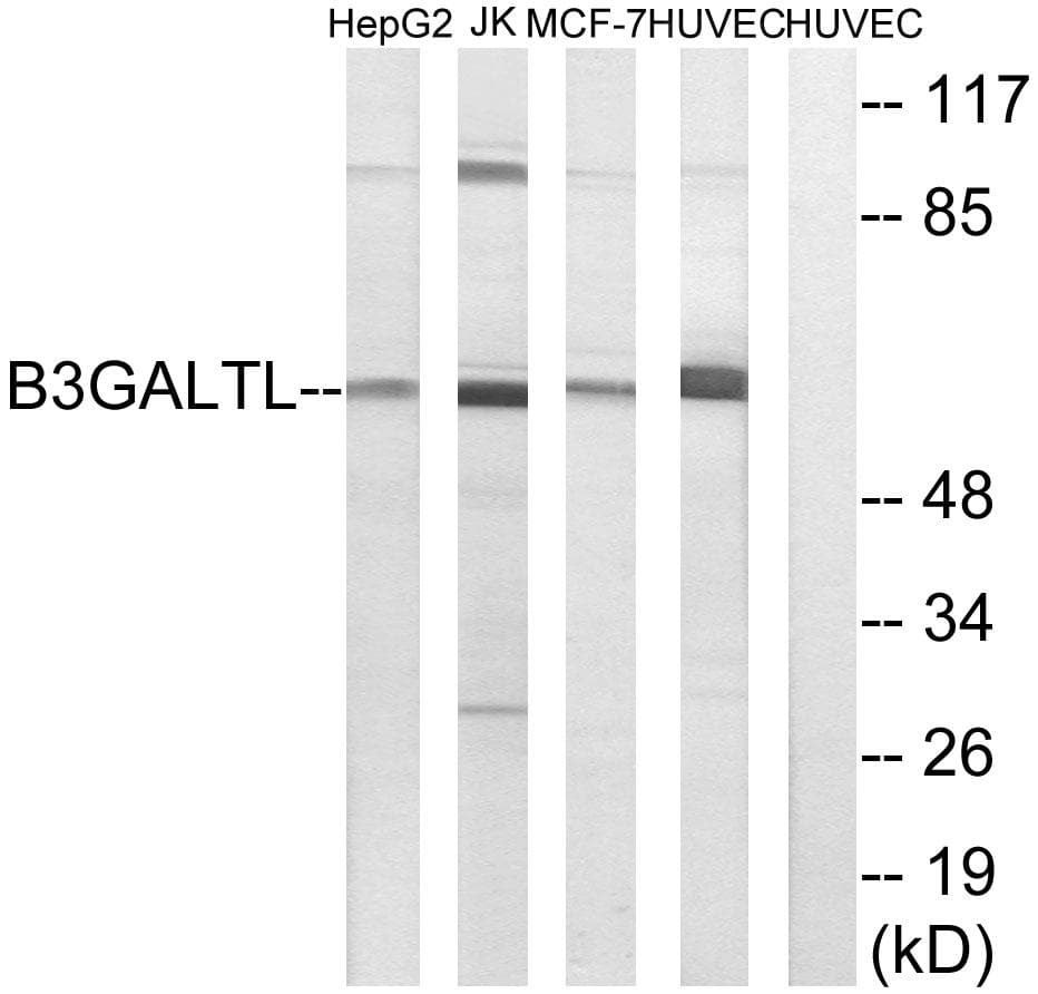 Polyclonal Rabbit anti-Human B3GALTL Antibody (IHC, WB)