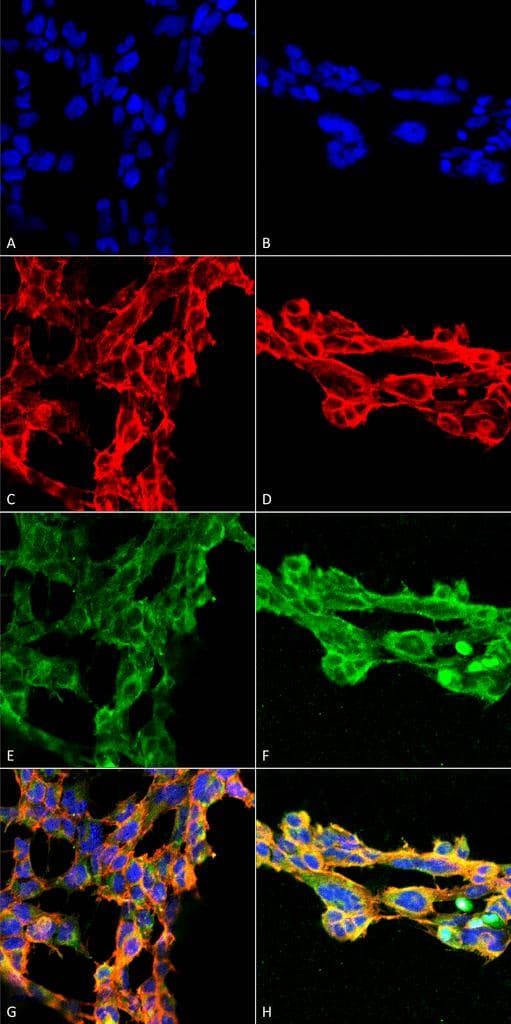 7-Ketocholesterol Antibody (clone 7E1, APC)