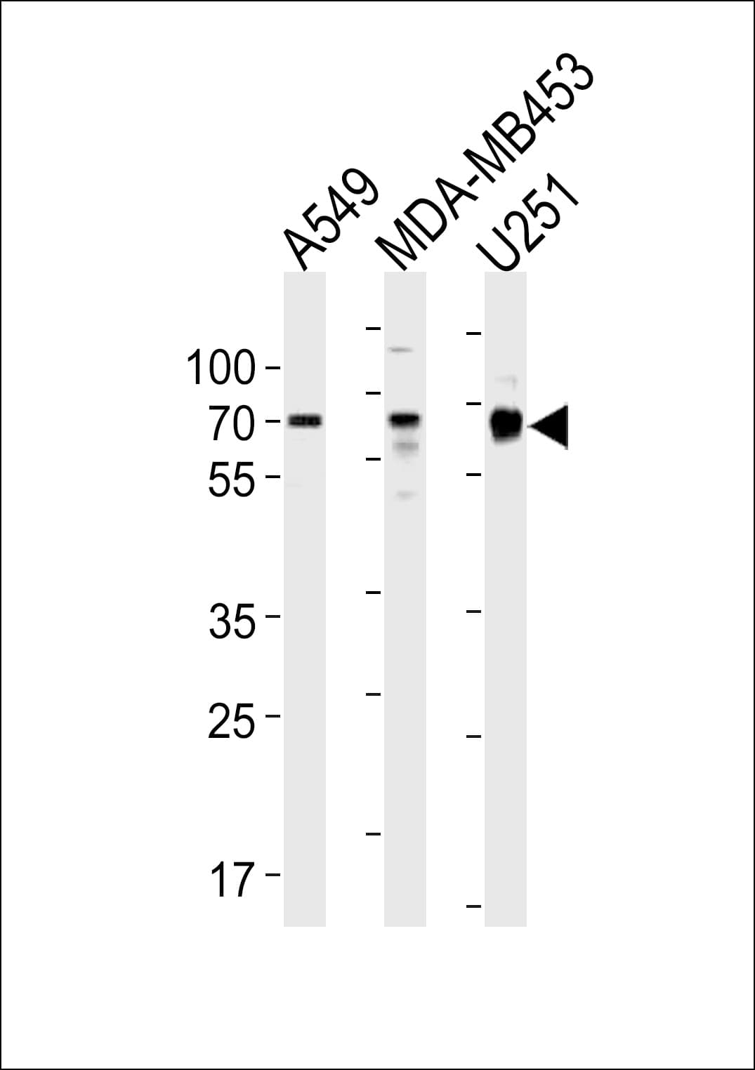 Polyclonal Rabbit anti-Human GRB10 Antibody (aa1-30, WB)