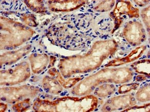 Polyclonal Rabbit anti-Human FGG / Fibrinogen Gamma Antibody (IHC, IF, WB)