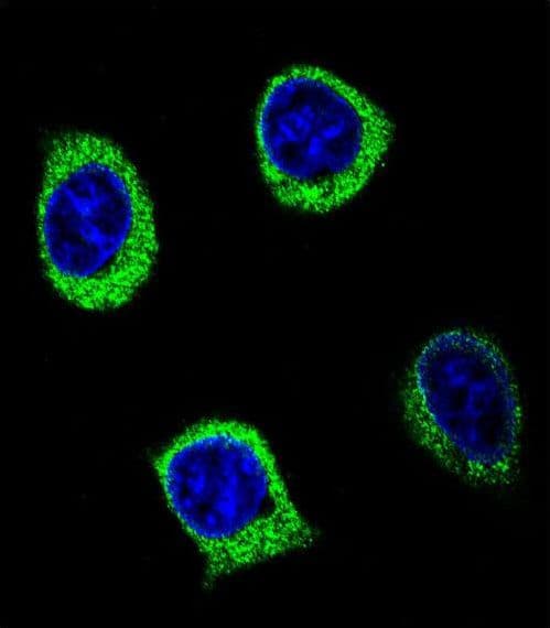 Polyclonal Rabbit anti-Human AMY2B Antibody (aa74-100, IHC, IF, WB)