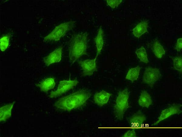 Monoclonal Mouse anti-Human TPM4 Antibody (clone 4E4-1D2, IHC, IF, WB)
