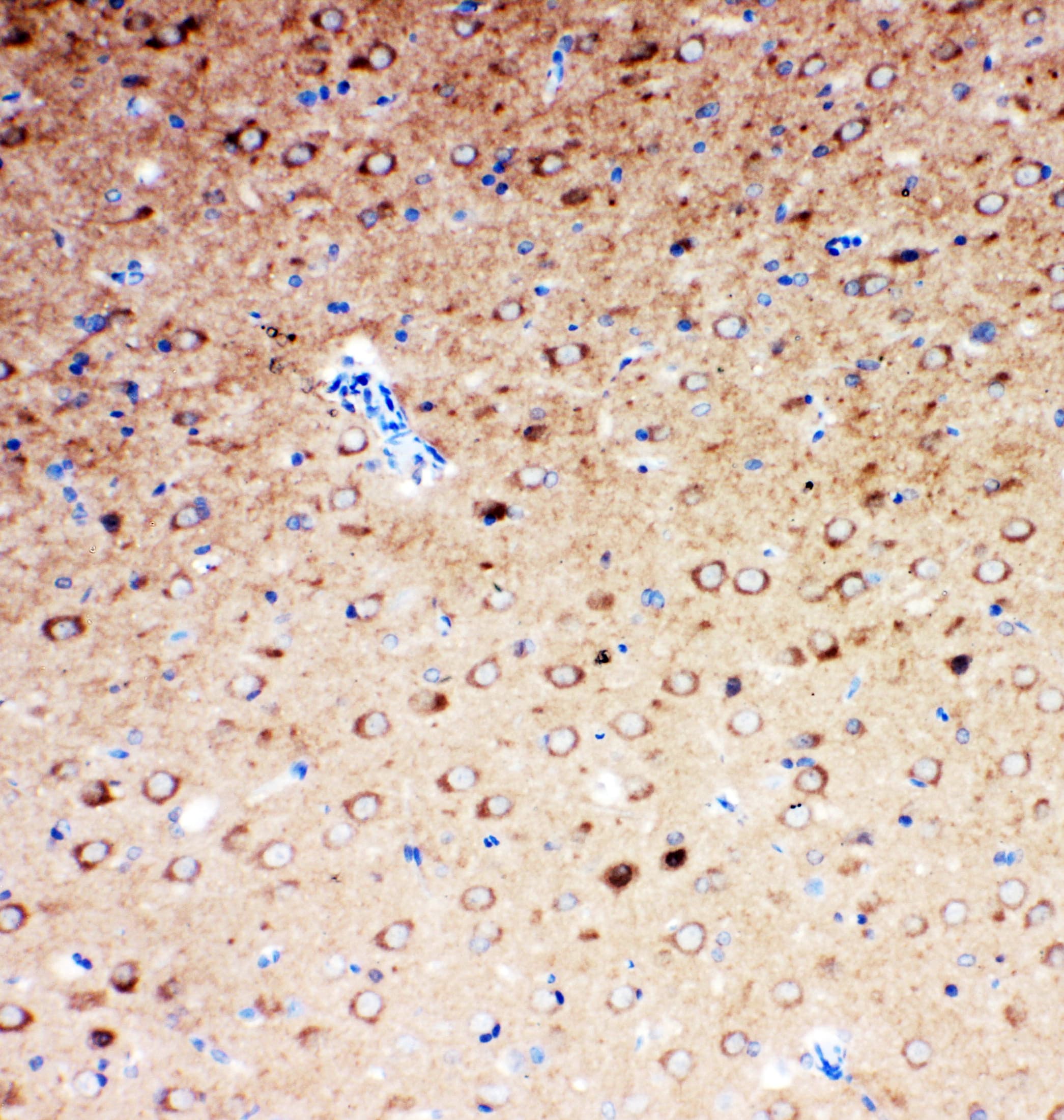 SLC6A4 / SERT Antibody (aa7-24)
