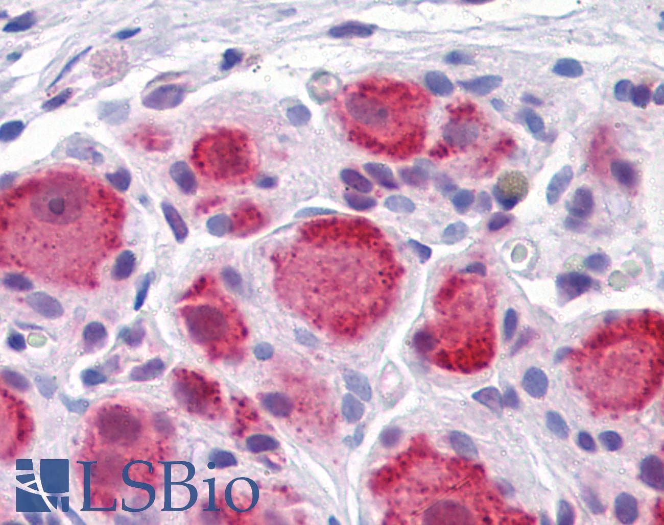 IHC-plus™ Monoclonal Mouse anti-Human DARS Antibody (clone 2F11, IHC, WB)