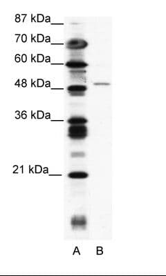 ZNF627 Antibody (aa44-93)