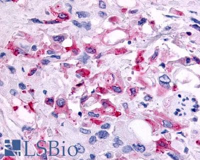 PathPlus™ CCR1 Antibody (Extracellular Domain)
