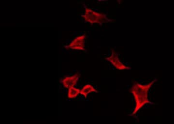 MMP19 Antibody