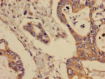 Polyclonal Rabbit anti-Human GCNT3 Antibody (IHC, WB)