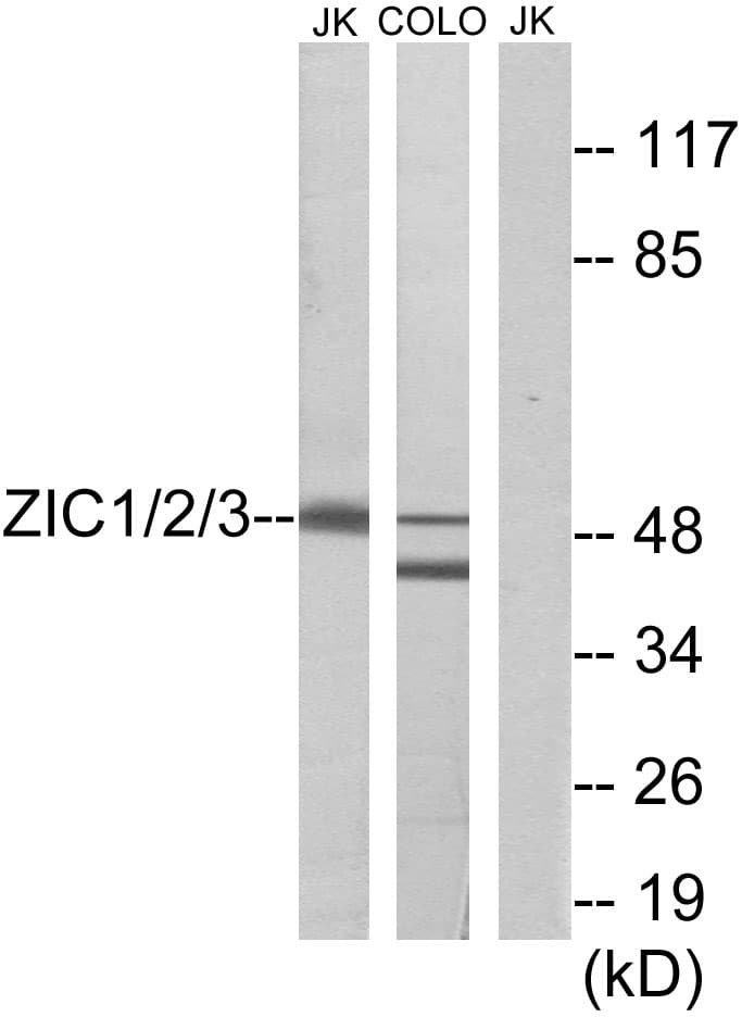 ZIC1+2+3 Antibody (Internal)