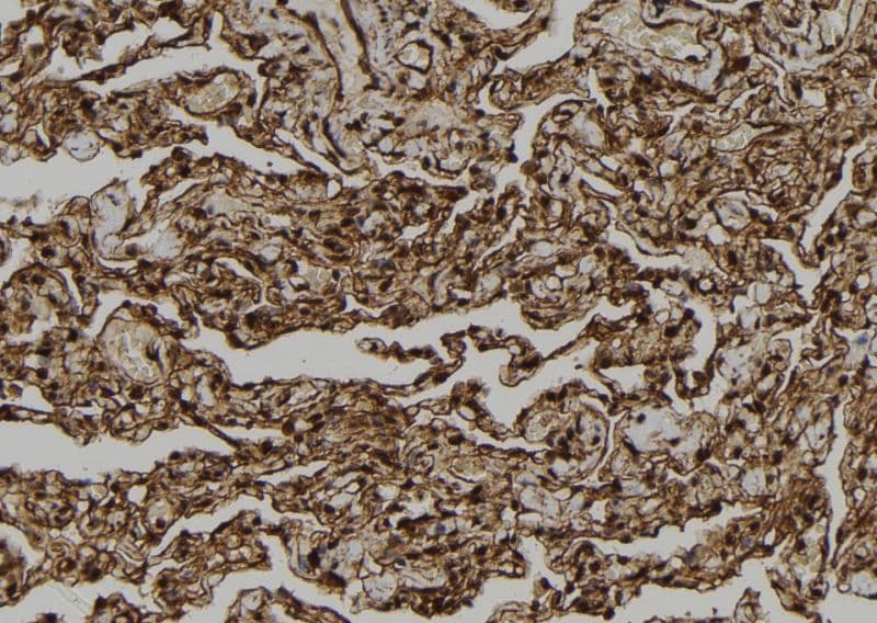 Polyclonal Rabbit anti-Human CARD18 / ICEBERG Antibody (aa62-90, IHC, WB)