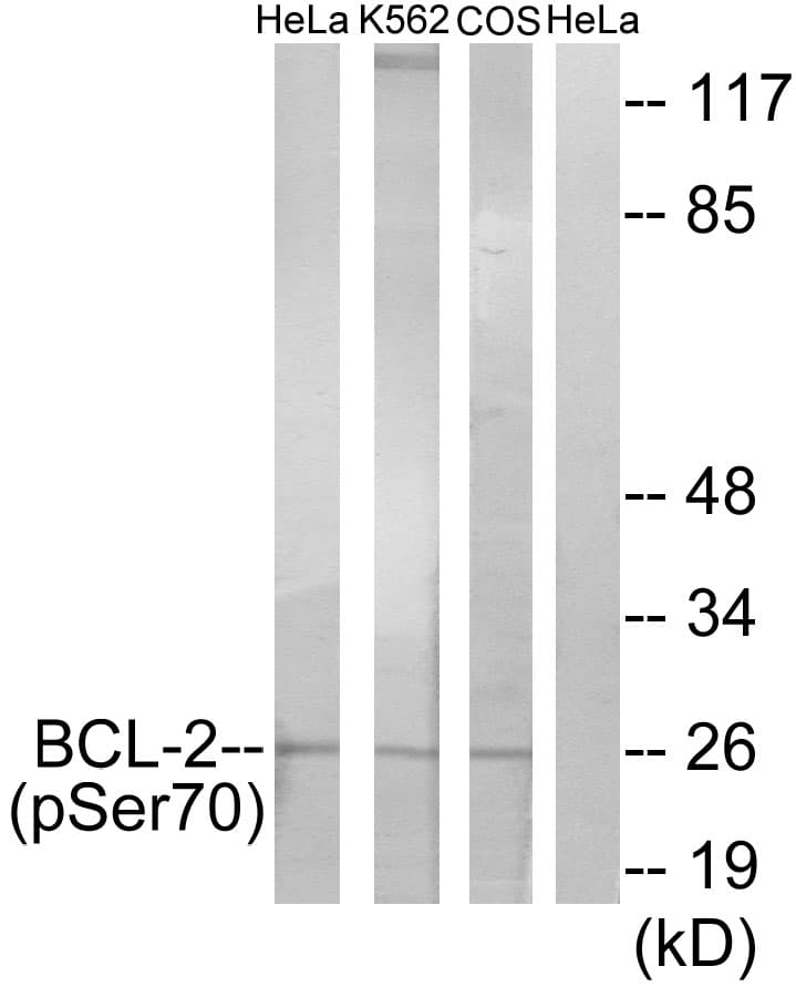 BCL2 / Bcl-2 Antibody (phospho-Ser70)