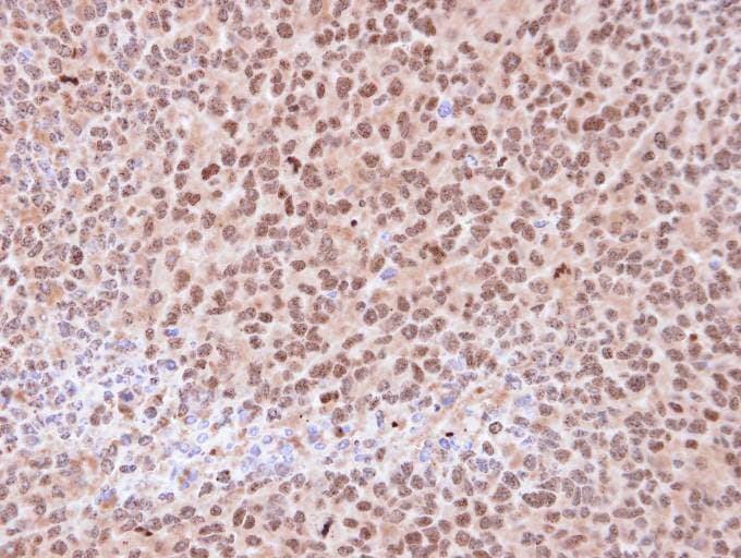 Polyclonal Rabbit anti-Human PSMA6 Antibody (aa57-274, IHC, WB)