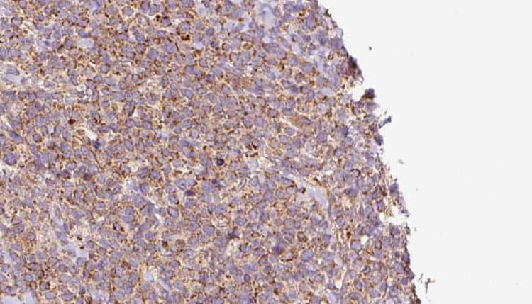 WBP2NL Antibody