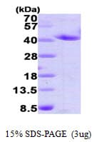 Human ANXA2 / Annexin A2 Protein (Recombinant His)