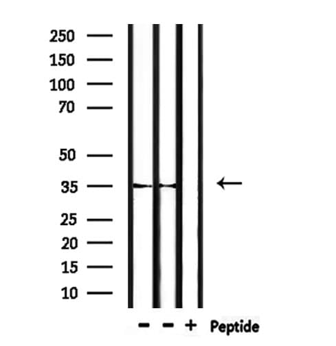 Polyclonal Rabbit anti-Human OR52P1P Antibody (WB)