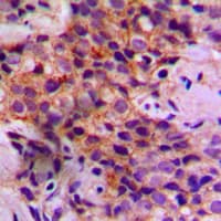 Polyclonal Rabbit anti-Human CASP2 / Caspase 2 Antibody (Internal, IHC, WB)